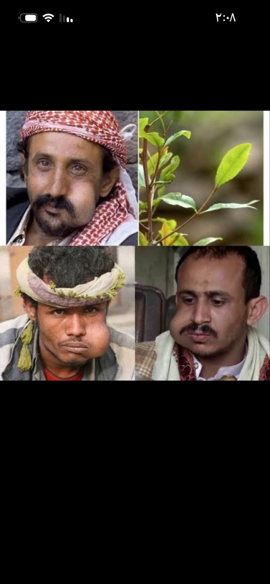 Agjsq4's tweet photo. @BdZyz84987 @Ir44aa @niran4465 اقسم بالله كلمة يمني تعتبر شتيمة ومسبه لدرجة الدحابشة الديول اليمنيين مثلك وشرواك ممنوعين من دخول كل دول العالم وشعبك الدحباشي الزيدي اليمني حلمه الهروب للسعودية يصير خدامة تحت كفالة السعودي وجرب يا زيدي يا قرد يا دحباشي يمني منحط تخطب سعودية أو خليجية والله يدعسونك لانك يمني😂 https://t.co/pUokh85MnB