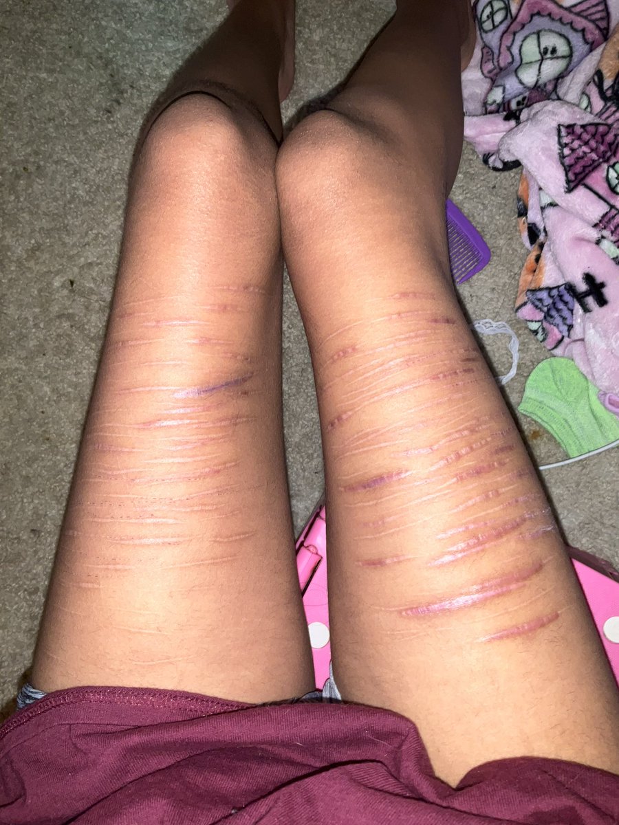 junebug_junoo's tweet photo. THESE ARE HEALED &amp; ai generated no one has been harmed ok😢😢 https://t.co/lMUyTEBbe2