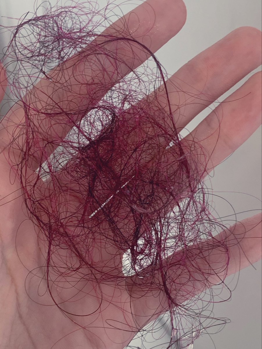 amobeabadoobee's tweet photo. gasto mares de dinheiro pra pintar o cabelo pra no final cair tudo a depressao eh mto contra mim serio https://t.co/PIovN2ohn3