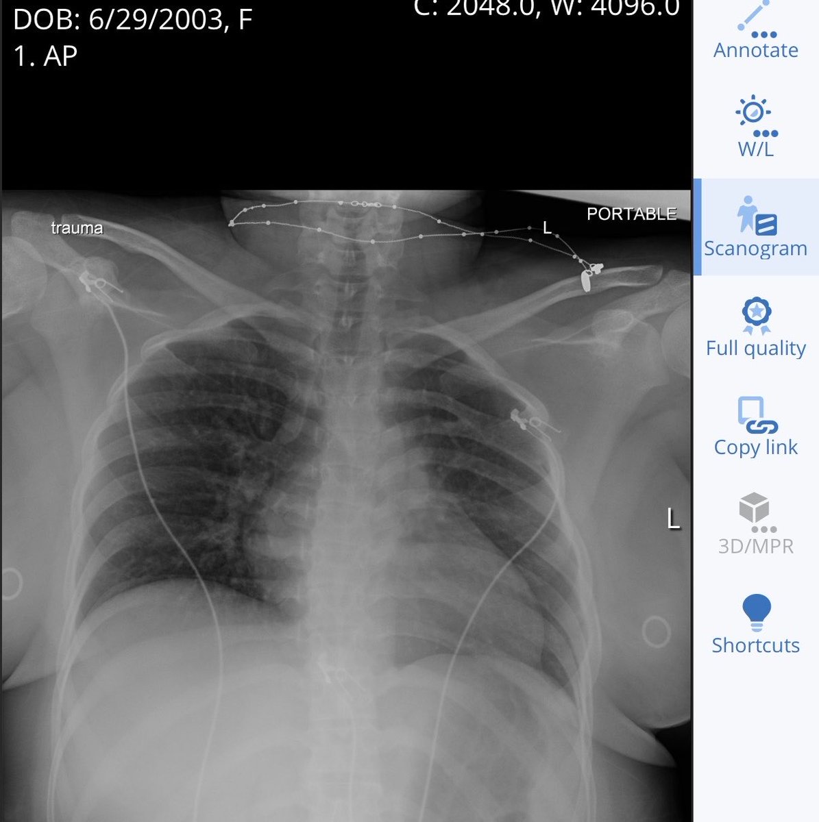 lostpuppypaws's tweet photo. boobs so big they don’t even fit in the xray https://t.co/iLdv93RRPr