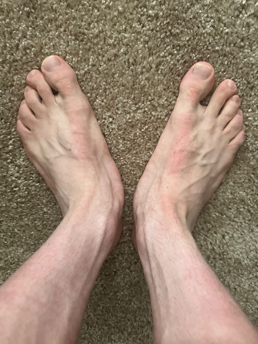 Blueishuge's tweet photo. Which one of you pathetic losers is gonna sniff my feet #findom https://t.co/ggKZ1N7IGy