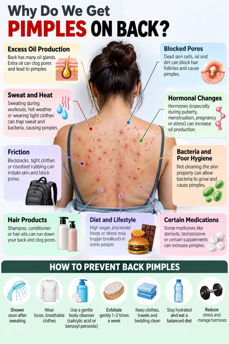 glowwellness085's tweet photo. Back pimples aren’t always about poor hygiene. https://t.co/PkUiDeqveU