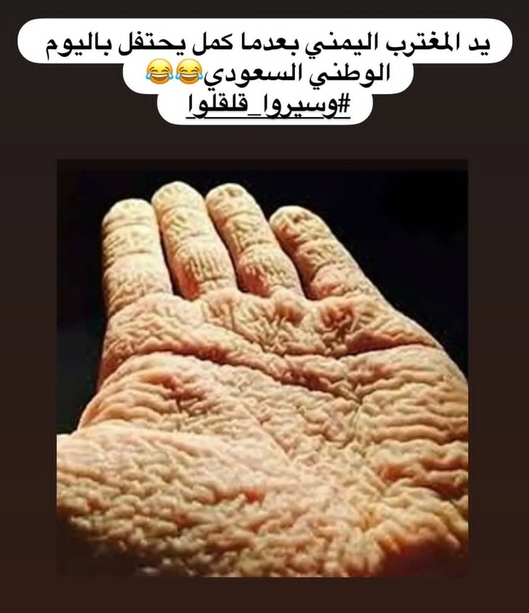 ufnxa's tweet photo. @alotb_l وافهمها😂😉 https://t.co/Xl8w5Mbn86