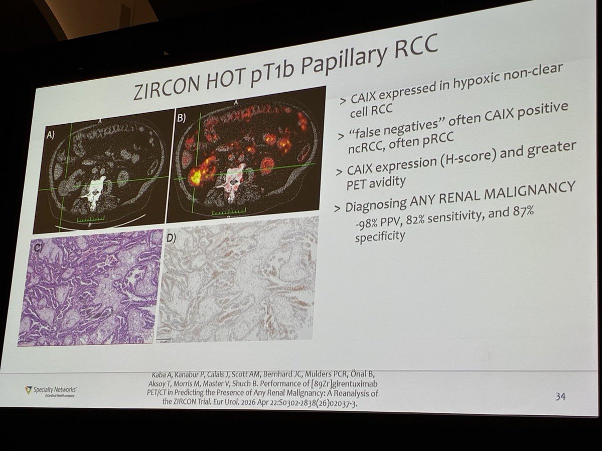montypal's tweet photo. At the Bladder & Kidney Cancer Academy (hosted by #DrNealShore @CURCMB & @TomJayram). Beautiful talk on #kidneycancer imaging from @KidneyCancerDoc who led the #ZIRCON study, hopefully leading to wide availability of CAIX imaging for our pts. Beyond this, great insights on use of sestamibi & #PSMA imaging.