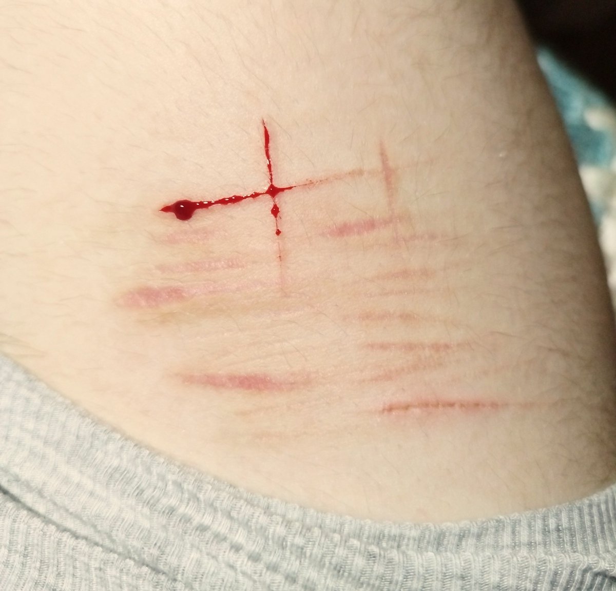 MasonicXo's tweet photo. FAKE !! SFX MAKEUP WITH AI !!

First post about my fake sfx makeup low-key nervous (⁠;⁠;⁠;⁠・⁠_⁠・⁠)

What do we think ? 🥹

#slitwt #sfx #shtwt #ouchie https://t.co/LDYmqwsedI