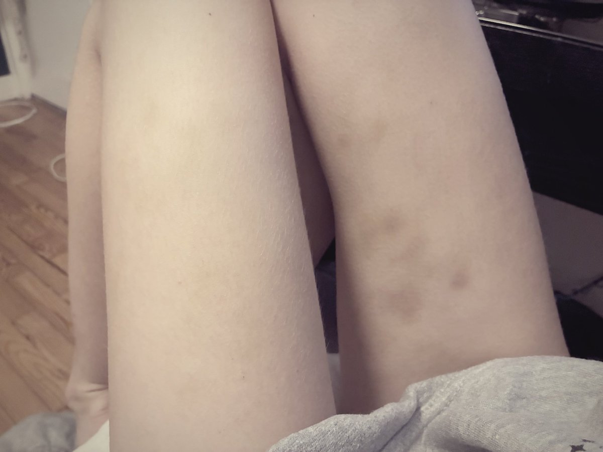 fnnnnnnni's tweet photo. Small bites #wlw #les #女同 -w- https://t.co/iqk1Df3uS8