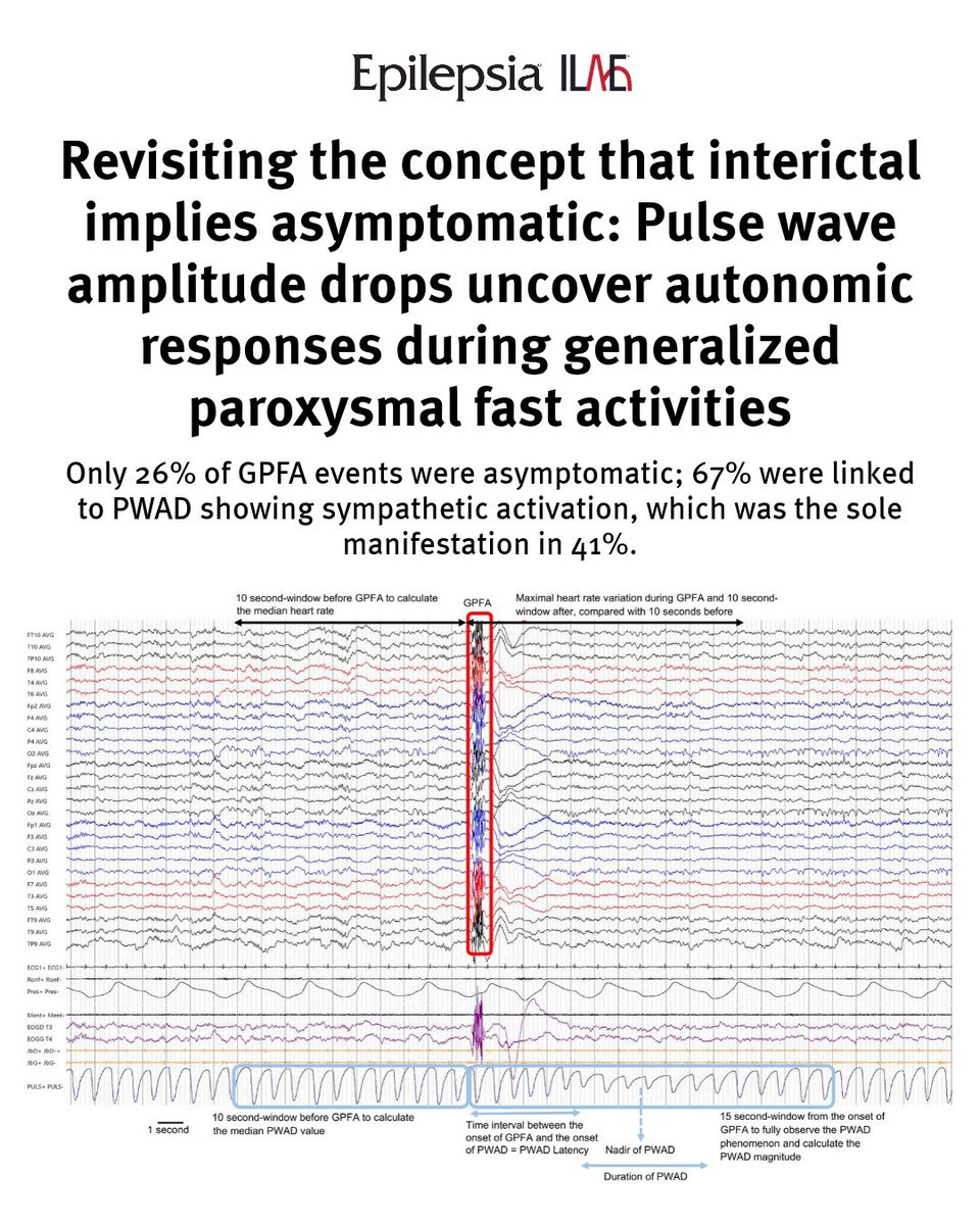 IlaeWeb's tweet photo. Key point: "PWAD occurrence was independent of GPFA duration, and even very short GPFA events were associated with substantial PWAD."

Read this open-access research article from @EpilepsiaJourn at https://t.co/jyVJUibvL5.

#epilepsy #brainhealth #neurology #epilepsyresearch https://t.co/HQflc06Qw1