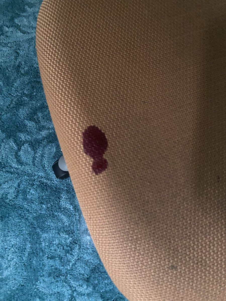 mockingstasis's tweet photo. why did i bleed in the shape of a buttplug https://t.co/cjCcBTypxA