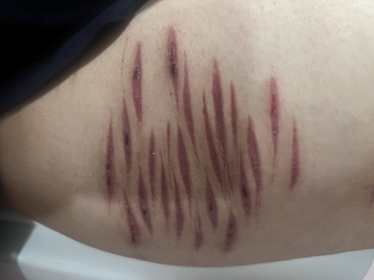 dtjcli's tweet photo. Stupid X made me delete this. Anyway, THIS IS FAKE CINEMA MAKEUP!

Scar check y'all, this is fake photo, my thighs are as clean as the bathroom's seat.

AI GENERATED PHOTOS
#sharmtwt  #sfwmakeup  #shrtwt #fake https://t.co/GrT2STT3C9