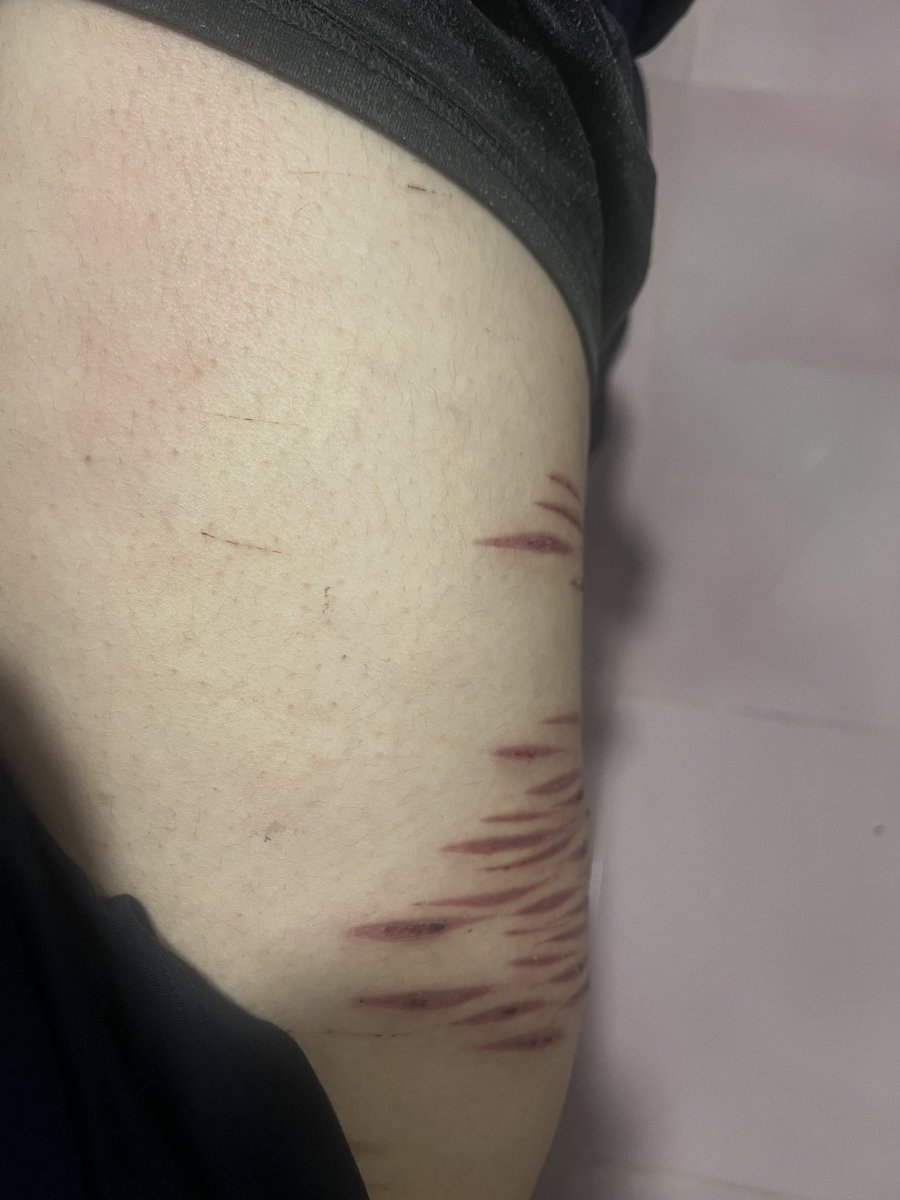 dtjcli's tweet photo. Stupid X made me delete this. Anyway, THIS IS FAKE CINEMA MAKEUP!

Scar check y'all, this is fake photo, my thighs are as clean as the bathroom's seat.

AI GENERATED PHOTOS
#sharmtwt  #sfwmakeup  #shrtwt #fake https://t.co/GrT2STT3C9