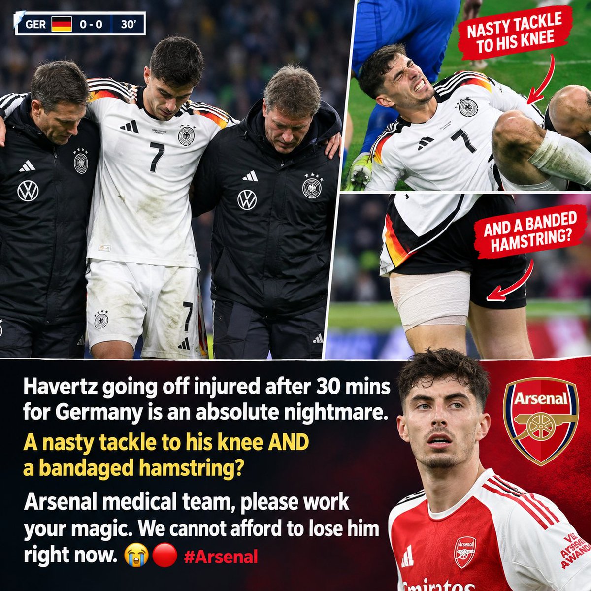 cest_legars's tweet photo. Havertz going off injured after 30 mins for Germany is an absolute nightmare. A nasty tackle to his knee AND a bandaged hamstring?

Arsenal medical team, please work your magic. We cannot afford to lose him right now. 😭🔴

 #GERNED https://t.co/EFTKXsYRty