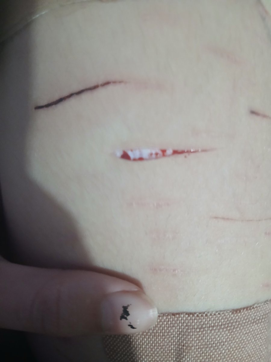 misothegoat's tweet photo. I think it almost reached bb bean
All sfx makeup!!
#sharm #shtwt #styro https://t.co/dHL3Q1fiaD