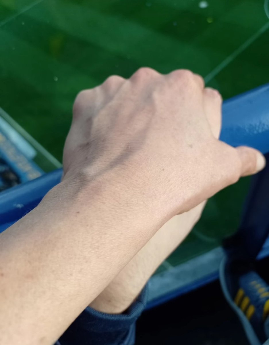 TatiiiCABJ's tweet photo. Manuel tiene 23 años. A los 17 sufrió un ACV hemorrágico que casi le cuesta la vida. En estos 6 años evolucionó muchísimo y hoy se está recaudando plata para que pueda realizar un tratamiento en India. A pesar de todo, nunca dejó de alentar a Boca Juniors 💙💛
capellanomanuel.bna https://t.co/XkiW7bIZxT