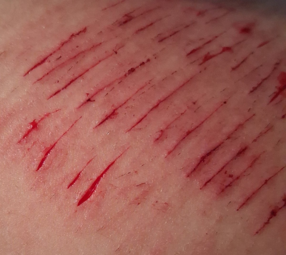 Cutmeandkillme's tweet photo. Finally some good fucking styros man 🤤 I've been putting this off for weeks cuz my leg was healing, but now I'm good to do SFX AI MAKEUP on them.
 .
.
.
.
.
.
.
.
.
.
.
.
.
.
AI SUPER AWESOME AI IMAGES.
#slittwt #slashflash #madeofstyrofoam #cuttwt #shedtwt #shhtwt #shrtwt https://t.co/lTfwT8Wxlm