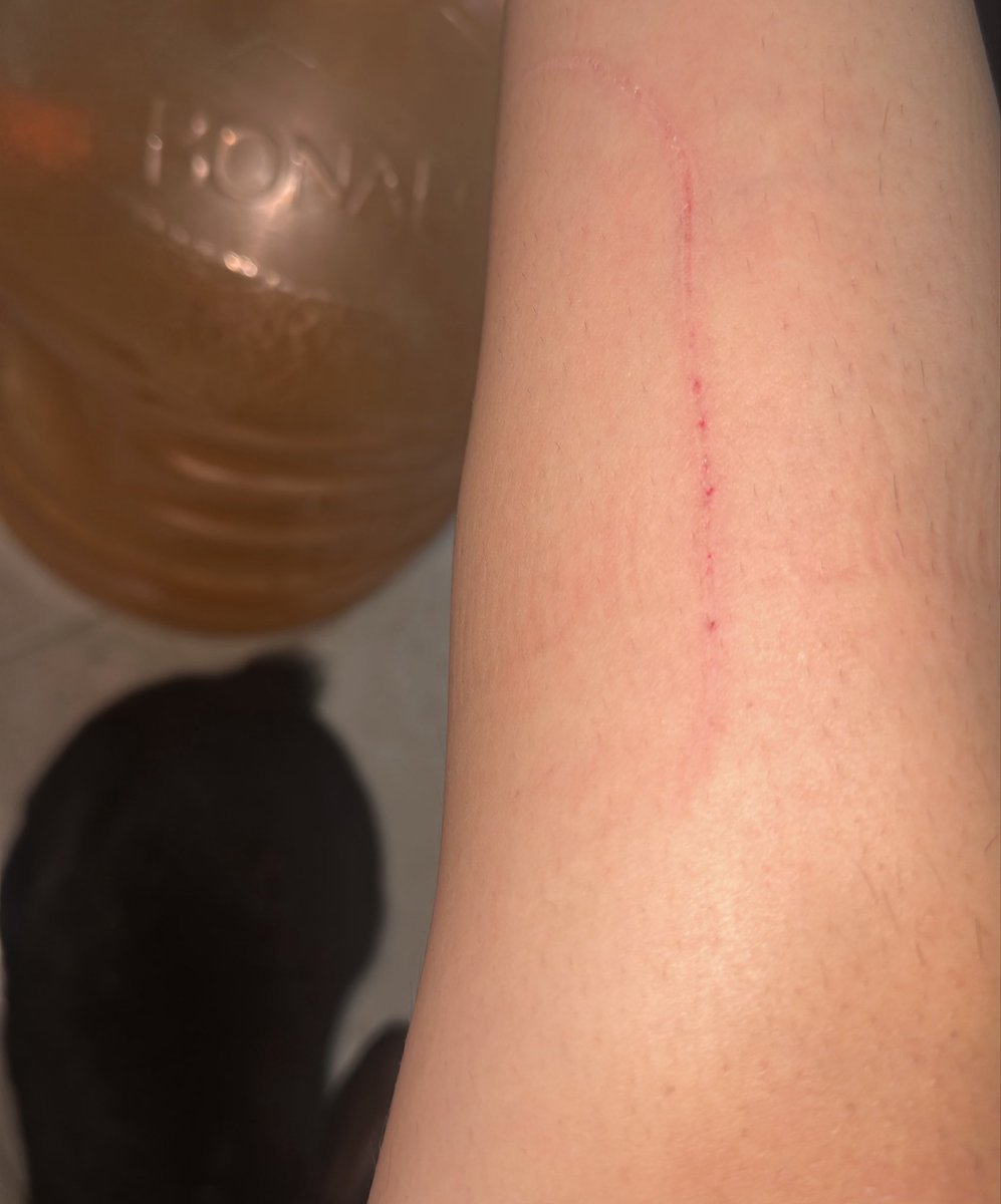 Liakx01's tweet photo. Mi conejo (el de abajo) me acaba de abrir la pata https://t.co/VWl33s0f5W
