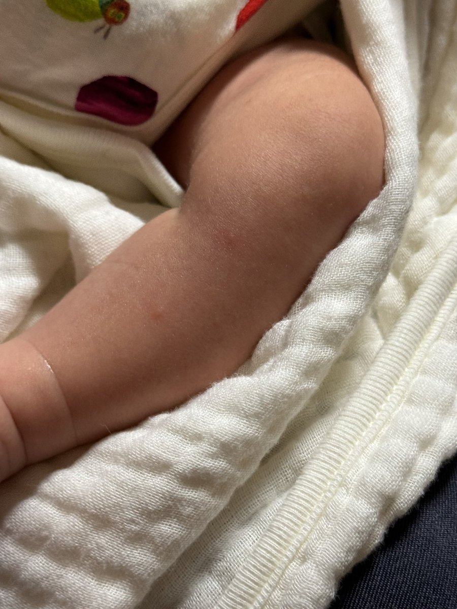 usuhadachann's tweet photo. ダニ？😭😭😭😭
鳥の糞に気づかなくて窓開けてたからかなー😭😭ウイルスもらいたくないから病院連れて行きたくなかったのに🥲 https://t.co/S90JaFcpVS