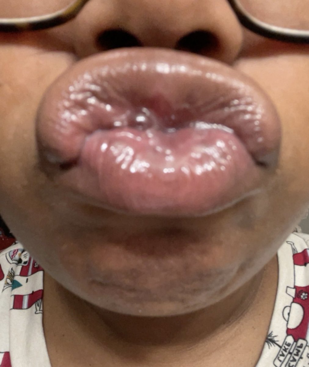 countessdragula's tweet photo. spend your check on nutty ass #dsl #lips #lipfetish #paypig #findom https://t.co/QzeQ3QwbIs
