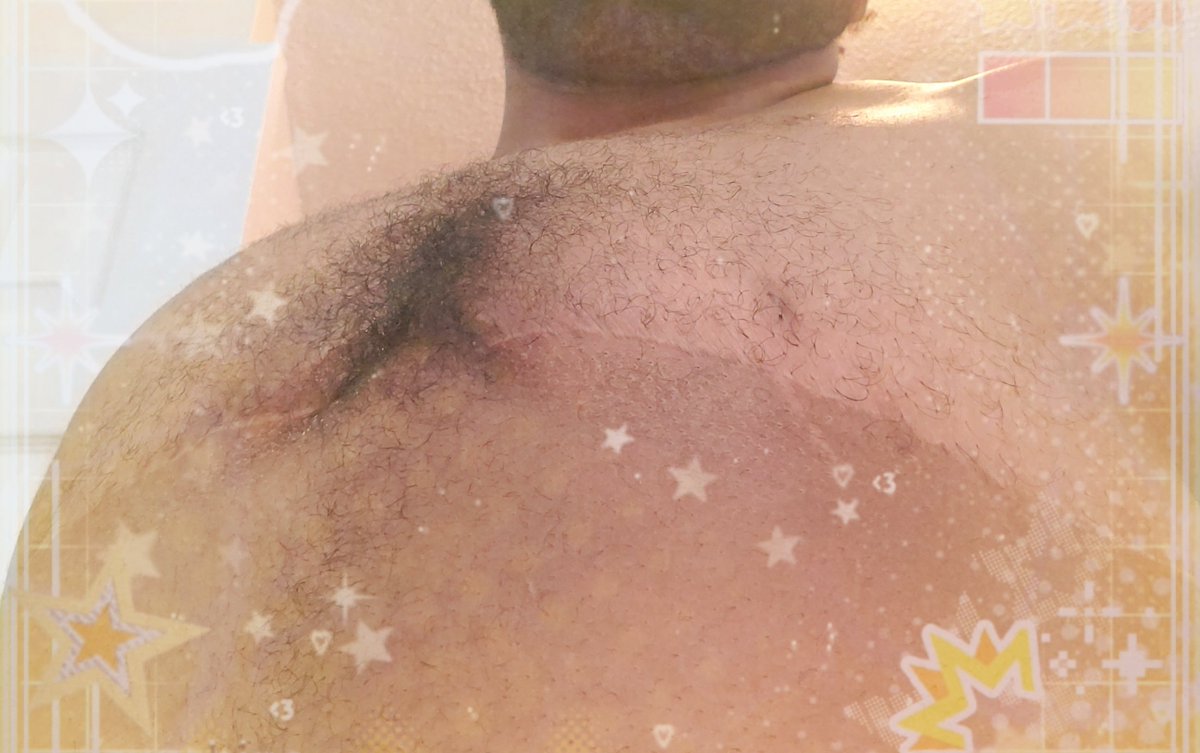 LupineLance's tweet photo. It's Thursday, you know what that means😊
-
#ftm #tboy #boypussy #boycunt #tdick #transman #nsfwtwtًً #nsfwtwt #ass #wetpussy #bigclit #creamypussy #spreadass #spreadpussy #hairypussy #hairychest https://t.co/mqQnVu57VO