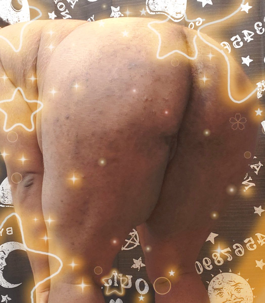 LupineLance's tweet photo. It's Thursday, you know what that means😊
-
#ftm #tboy #boypussy #boycunt #tdick #transman #nsfwtwtًً #nsfwtwt #ass #wetpussy #bigclit #creamypussy #spreadass #spreadpussy #hairypussy #hairychest https://t.co/mqQnVu57VO