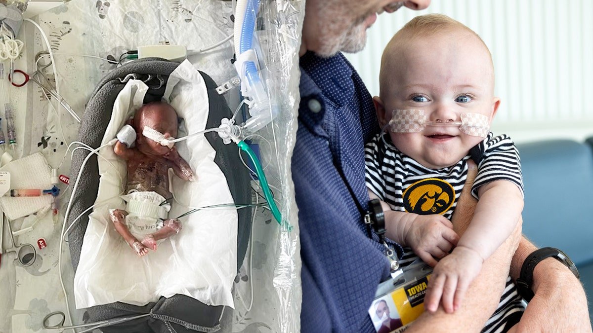 Vanillabwnny's tweet photo. I've lost a lot of respect for asmondgold as im extremely prolife.

Abortion up until birth is insane. This baby was born at 21 weeks and is now currently a toddler. How can you look at a living human being and say that they deserve to die. https://t.co/WCcv857FRN