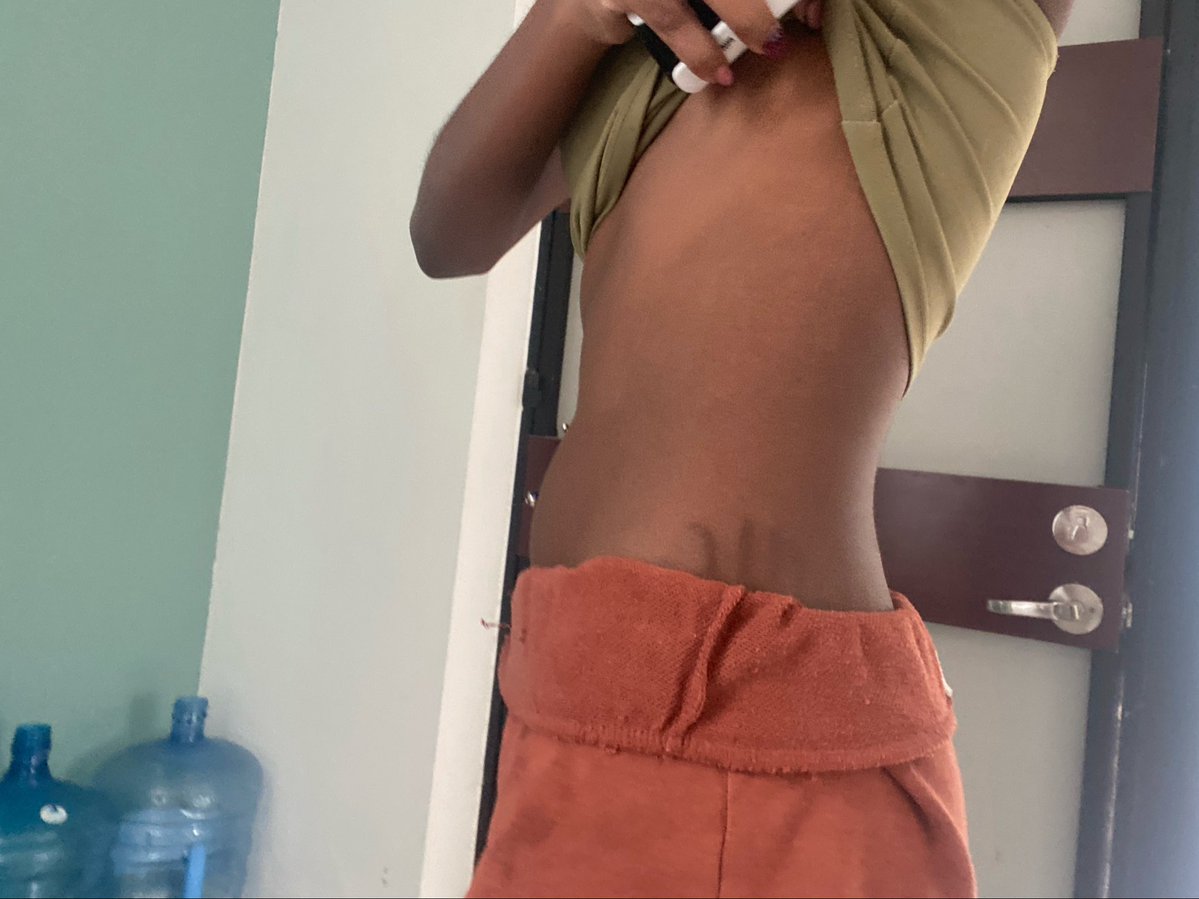 kalib3by's tweet photo. bodycheck
ignore my fit im comfyyy
ugh i hate how i've lost sm but still have stretch marks https://t.co/C3Tl1XGjyk