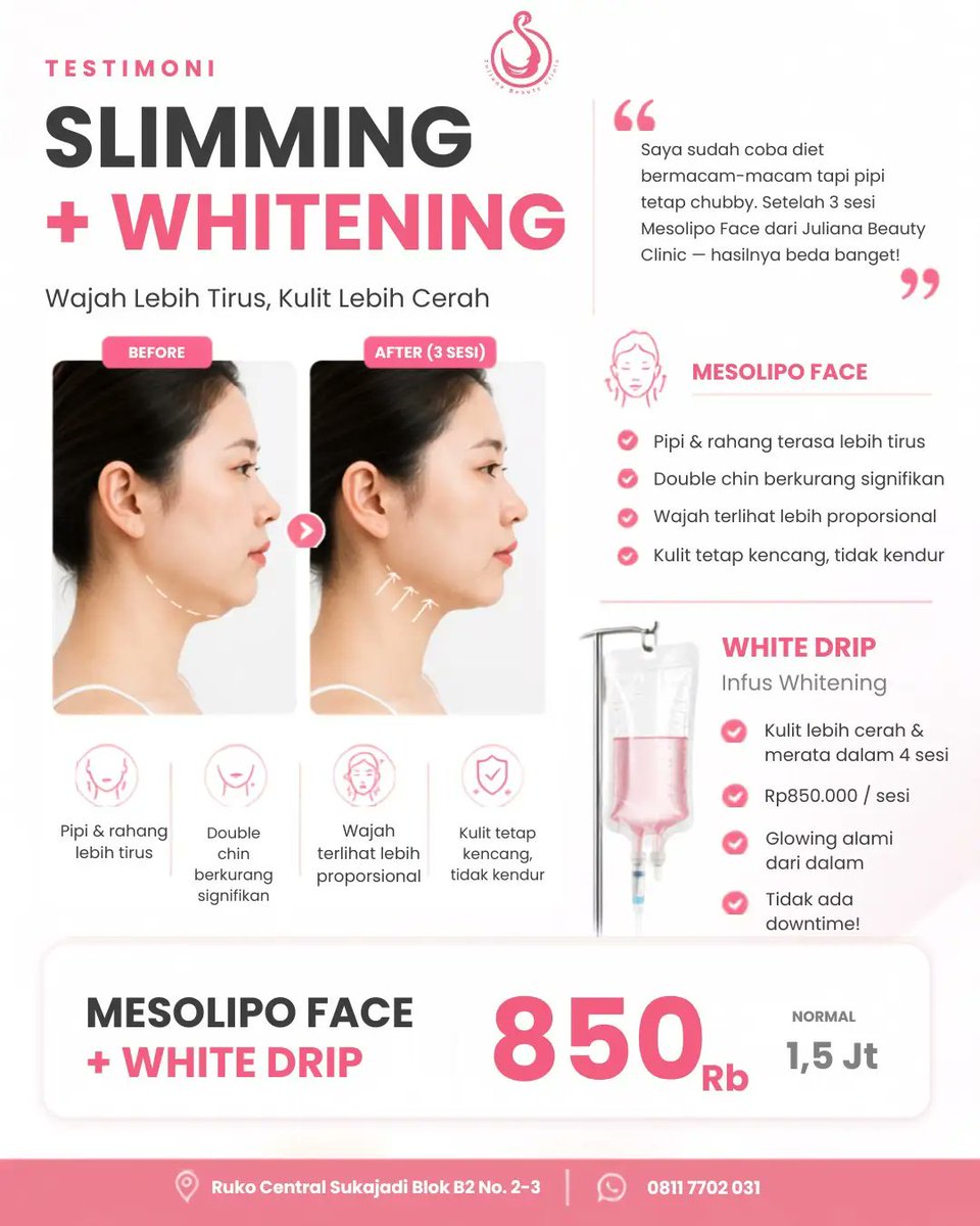 hazelwilliamsek's tweet photo. Slimmer-looking face and brighter-looking skin with the Mesolipo Face + White Drip combo. Special price: IDR 850, 000, from IDR 1. 5 million. Upgrade your confidence today! Reserve: 0811-7702-031 https://t.co/MJogRACFqM