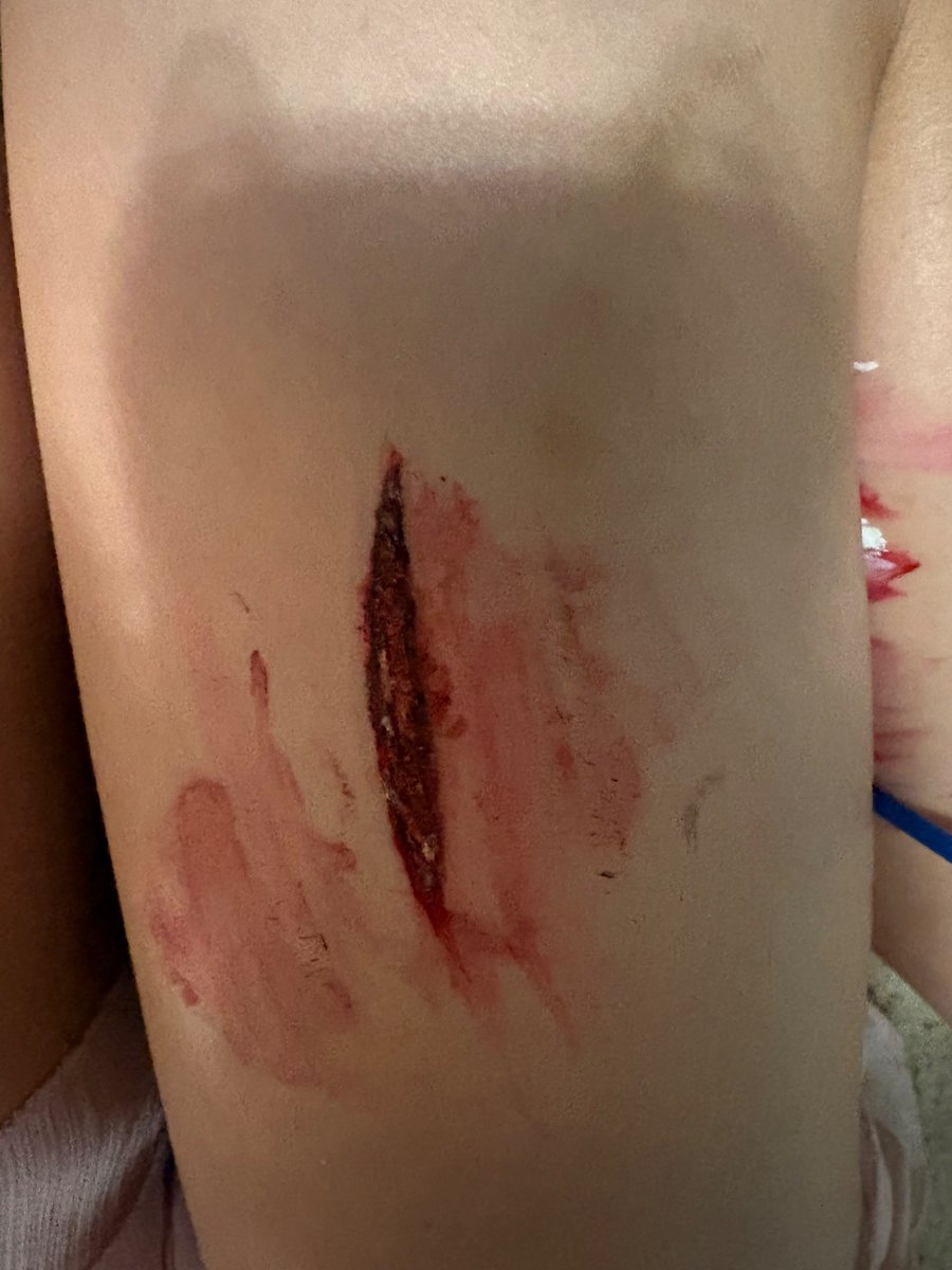 pawsatycu's tweet photo. camera quality is shit but jh
— sfx makeup yay —
messing around with some of my supplies! not my best work but das ok all i had was paint and markers https://t.co/5YsPe5aCs6