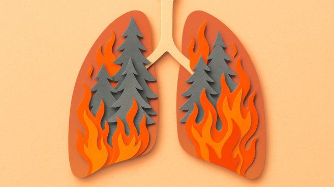 StanfordDeptMed's tweet photo. #Wildfire smoke is becoming a seasonal reality in the U.S. & beyond. #StanDOM's Sharon Chinthrajah says the health impacts go far past eye & lung irritation, including lasting immune cell changes tied to repeated exposure. Read more: https://t.co/afuy2tRSVd https://t.co/gWsDlewLSL