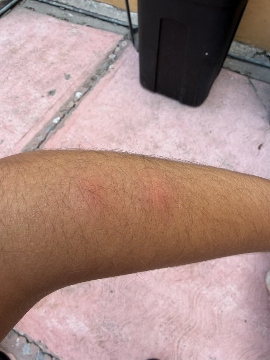 callmesweetiie's tweet photo. @Uber_MEX el día de ayer realice un viaje, solo para llegar a mi casa y darme cuenta de que el auto estaba infestado de chinches. Yo sé que es imposible regular a todos los conductores, pero no deberían permitir dar servicio en estas condiciones @Uber_MEX https://t.co/XLjpb2ffav