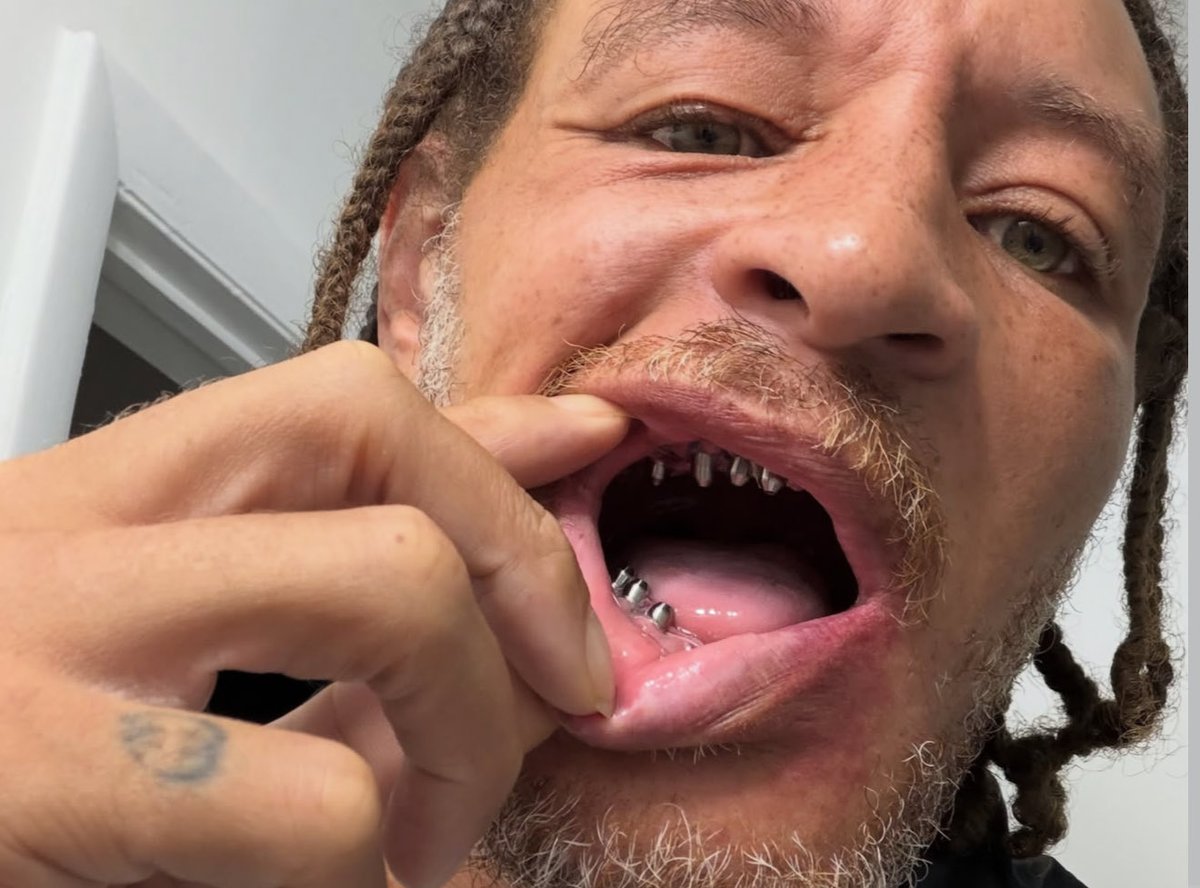 TheCosmeticLane's tweet photo. Ayyyy it looks like Delonte West was able to get himself a Smile Makeover while on his recovery journey! 🦷✨ https://t.co/gt7U4Ke0FI