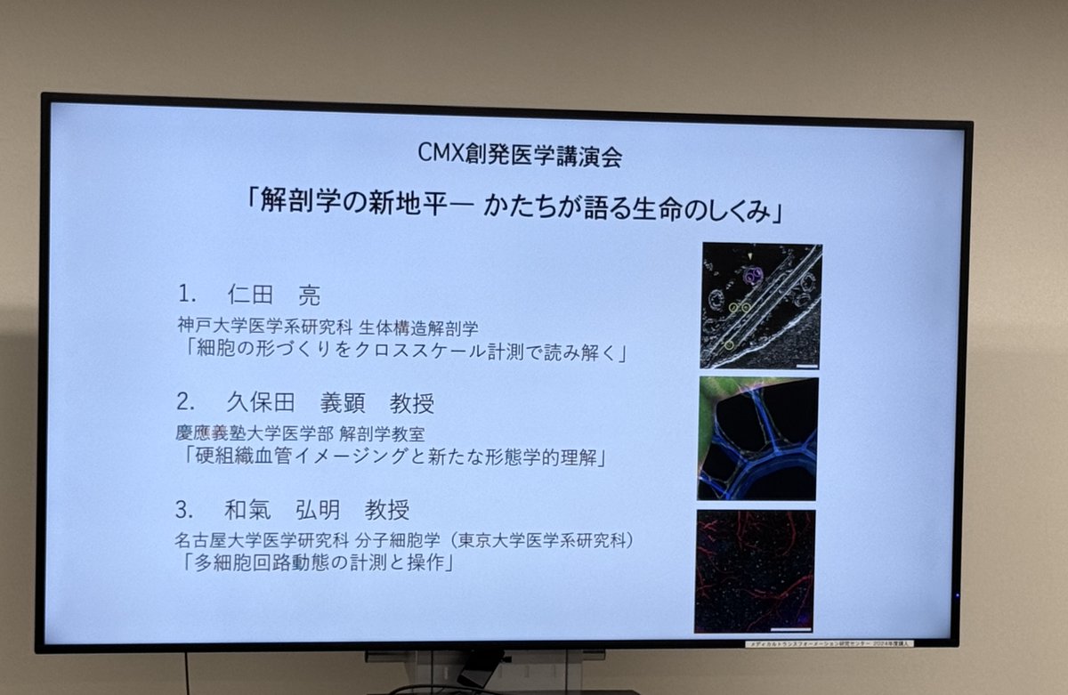 kobeu_cmx's tweet photo. 9/24開催のCMX創発医学講演会「解剖学の地平線ー形が語る生命の仕組み」では久保田教授(慶応大)、和氣教授(名古屋大)をお迎えしました。
個体・組織・分子・原子に至る多階層の「かたち」を可視化する最先端研究が紹介され活発な議論が行われました。https://t.co/HE798XOAtk https://t.co/iRggPVMZvP