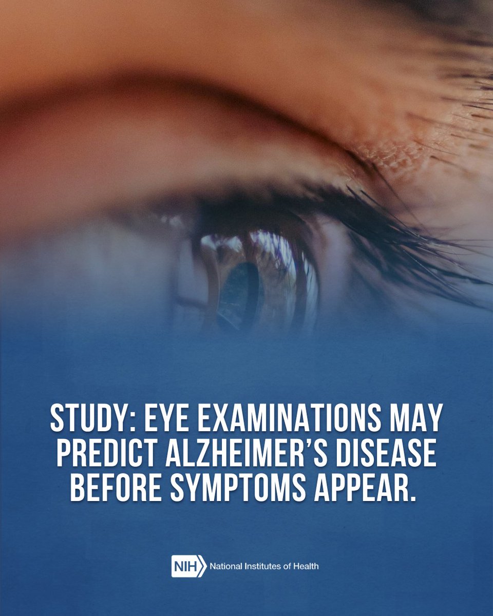 A close-up of an eye against a blue background, accompanied by text that reads: "STUDY: EYE EXAMINATIONS MAY PREDICT ALZHEIMER’S DISEASE BEFORE SYMPTOMS APPEAR." The National Institutes of Health (NIH) logo is at the bottom.