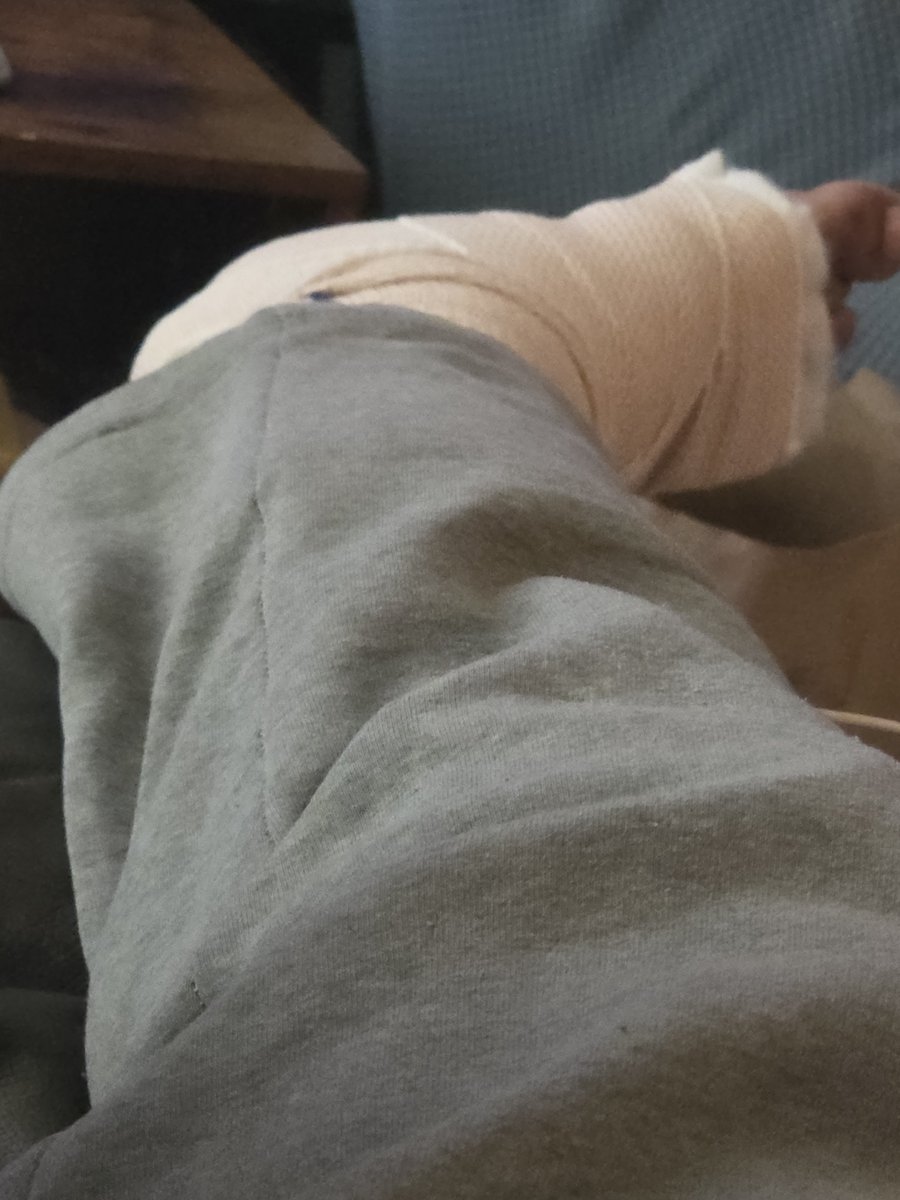 ViraTuber's tweet photo. Alot of peeps have been wondering on here too so let me update you guys. I wont be active for a few days as ive gotten hit by a vehicle pretty damn bad. Got a cast for my right left mow and some nasty cuts on my body. ;_;
. It sucks but ill get through this,im a strong fish. https://t.co/mT4KJjS3Tl