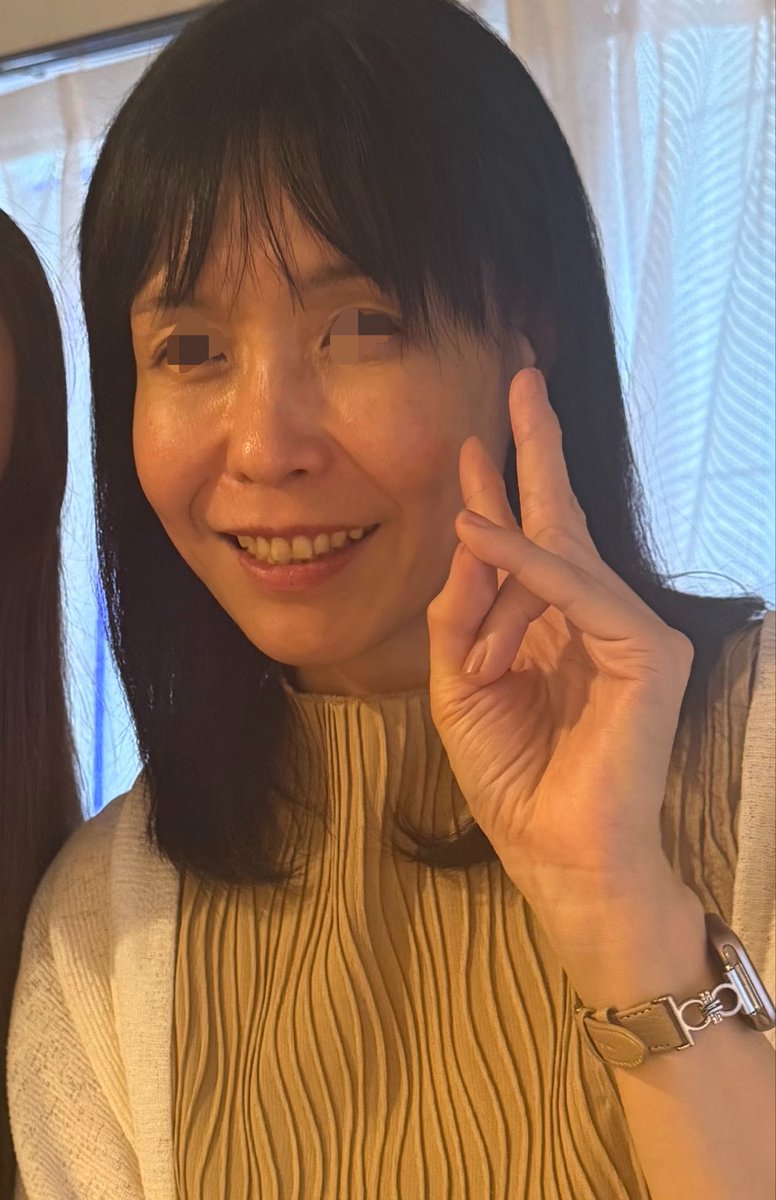 vs5or's tweet photo. ミニフェイスリフト前の多分最後の他撮り（前髪が最悪🥲）
前にもポストした先日のオフ会でのもの。
手が邪魔なのと照明の関係で見づらいけど笑うとめっちゃドレープできるので少しは解消されてほしいな…
関係ないけど昔から口元が自分でもキモくて矯正してもキモさ変わらずで辛い。 https://t.co/IpXtlyXDgm