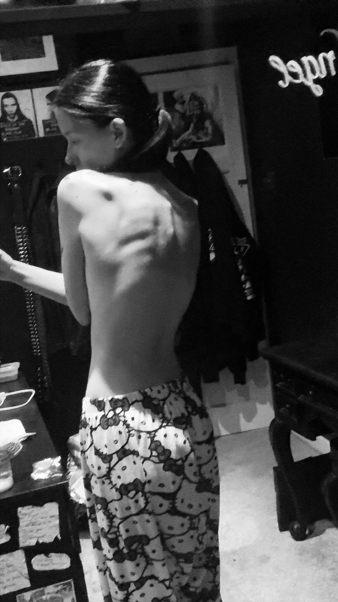 daintydisturbed's tweet photo. couple bodychecks from the past few months need to take new oneezzz https://t.co/LgHBB6gkIp