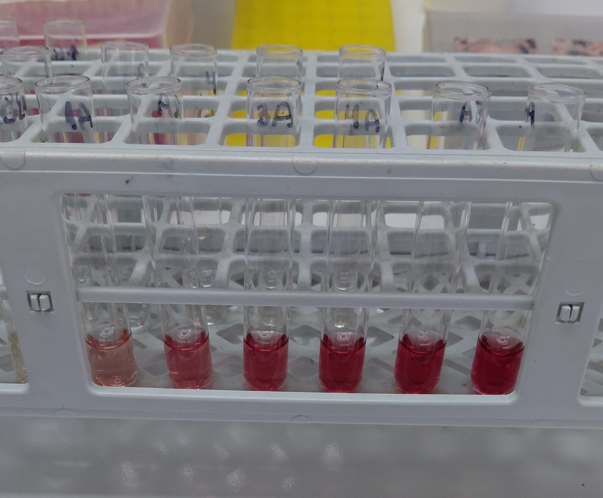 lyttea07's tweet photo. miren mis tubos con glucosa (tuve que descartar 2 valores pq pipetie mal 😃; extraño mis labs de qca organica) https://t.co/9CS0OMsbAG