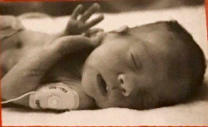 LifeNewsHQ's tweet photo. Baby Soaked in Toxic Solution for Five Days During Saline Abortion, But She Survived https://t.co/lsKTG0xr9V https://t.co/zduNPIVLoM