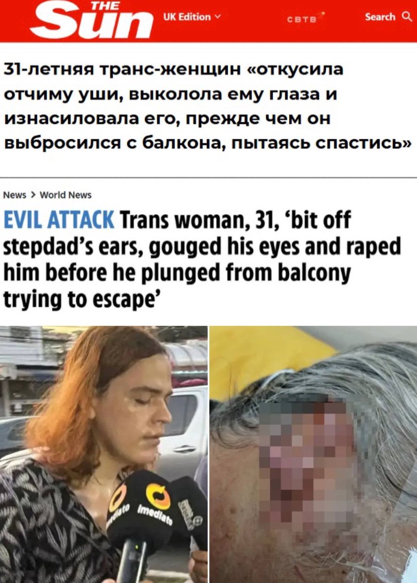 svtv_news's tweet photo. В Бразилии трансгендер изнасиловал своего 61-летнего отчима, выцарапал ему глаза и откусил ему уши

Ужасающий инцидент произошёл в городе Манаус 16 сентября. В тот день 31-летний Аврора Наоми Ла Фей, считающий себя женщиной, покурил марихуану и якобы начал испытывать галлюцинации. После этого он атаковал мужа своей матери.

Сначала трансгендер начал жестоко избивать мужчину и вгонять пальцы в его глазницы, а затем откусил ему уши. Когда пострадавший потерял сознание, пасынок его изнасиловал. Впоследствии уже потерявший зрение мужчина пришёл в себя, дошёл до балкона и сорвался с него.

Преступник утверждает, что частично забыл детали произошедшего, однако отрицает факт совершения сексуального насилия. По предварительным данным, пострадавший и транс находились в напряжённых отношениях, поскольку отчим не считал пасынка женщиной.