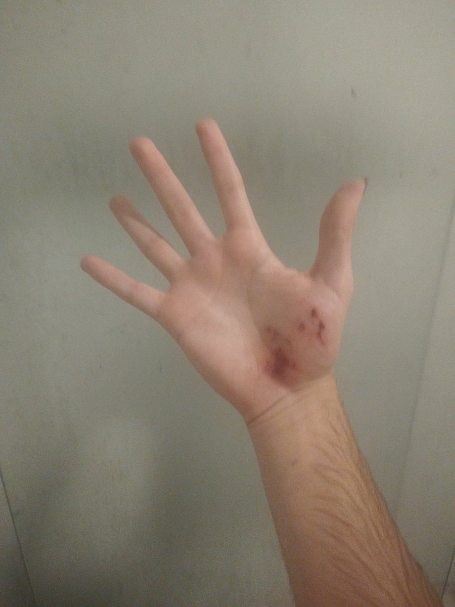 ItsNotLotteBro's tweet photo. NAO DA PRA BATER E LIMPAR O CUUUIUIUUU https://t.co/R1F2Ddvfpa