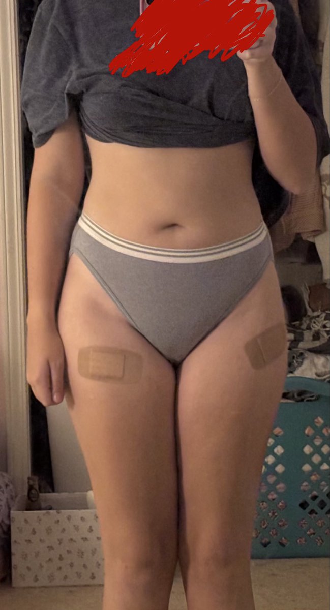 amexpqh's tweet photo. small bc cause i thought it was silly i have bandaids on both thighs 🥹 https://t.co/SalhjpXIgS