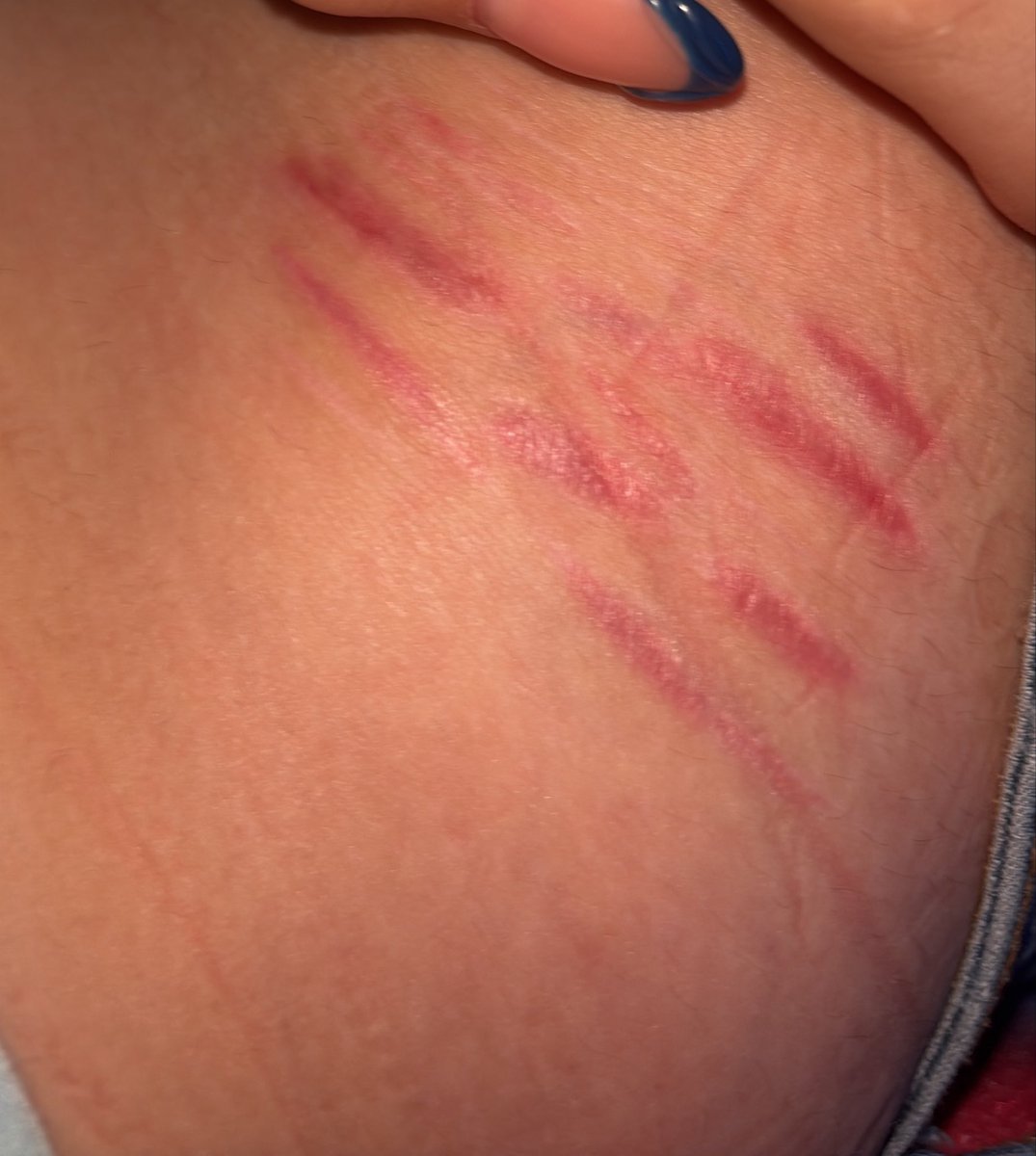 ohanA73288173's tweet photo. Where can I do a new cvt?!#sh #shtwt #selfharm #cuts #scars SFX MAKEUP PRACTICE https://t.co/wiqTsRDJF6