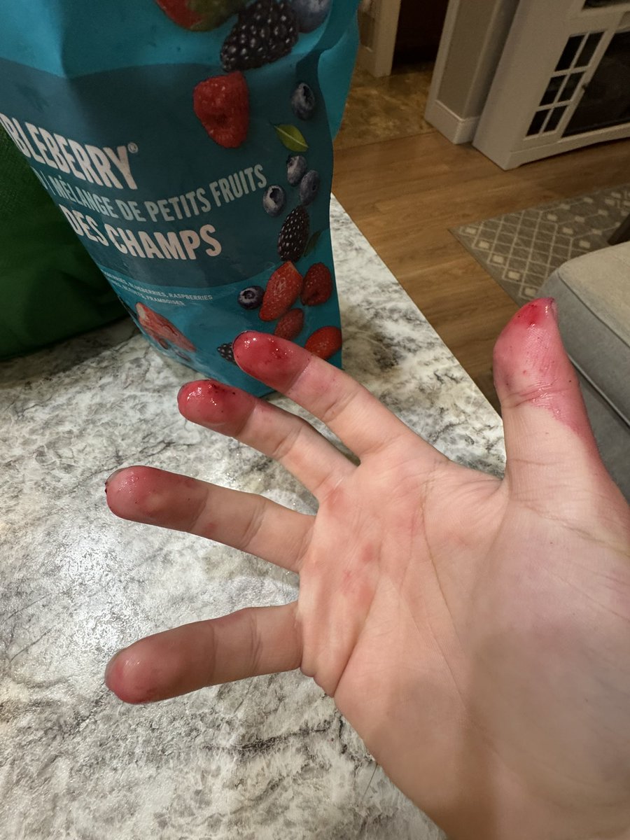 ColdToenail's tweet photo. rahhh https://t.co/HoS6TFATDd
