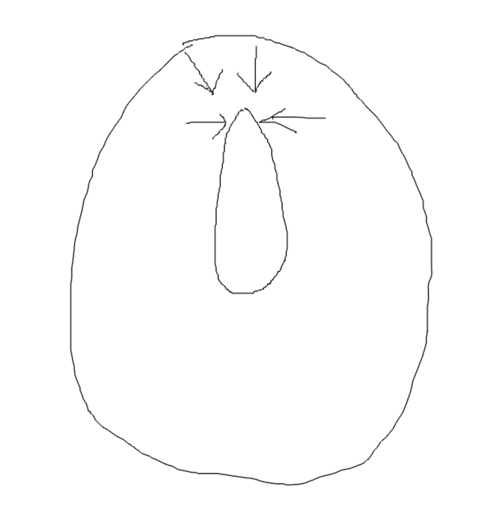 stoneString_coc's tweet photo. @Izuna_ryo 本気でむかついたのよ！！！！！！！！
絵で描いたこの飴の真ん中の気泡とんでもなく鋭くて、痛みで口から出した時ちっさく肉っぽいのついてたし
勘弁してくれ～～～～～～～ https://t.co/P6YRbG31v0