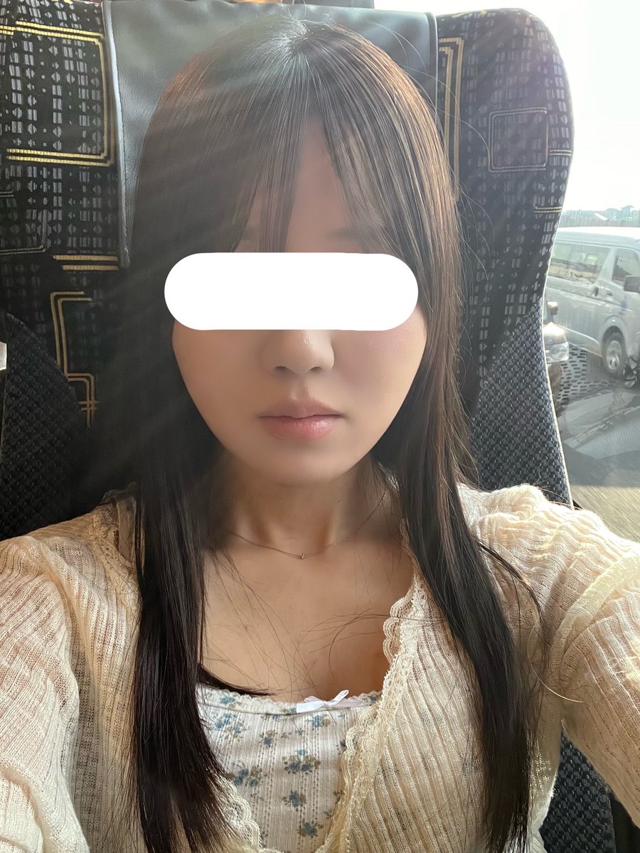 6gC21's tweet photo. クォンタムRFダウンタイム1ヶ月
ひょうたん輪郭⬅️からｺﾘ✨➡️
（肌加工のみしてます） https://t.co/wGMPWpNOum