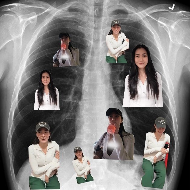 imurhome88's tweet photo. Orm X-Ray Diagnosis 🩻
Full of Lingling Kwong 555555555

#LingOrm #หลิงออม https://t.co/afPL0mg5tF