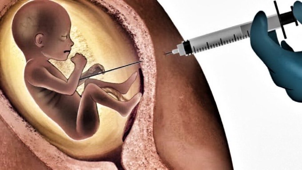 porlavida2014's tweet photo. El #aborto con cloruro de potasio, conocido como asistolia fetal, es un procedimiento médico cruel que consiste en inyectar esta sustancia en el corazón del feto mientras aún está en el útero, provocando la muerte por paro cardíaco en el bebé… CRUELDAD MÁXIMA. 
#SiALaVida https://t.co/pAgRdRUhtj