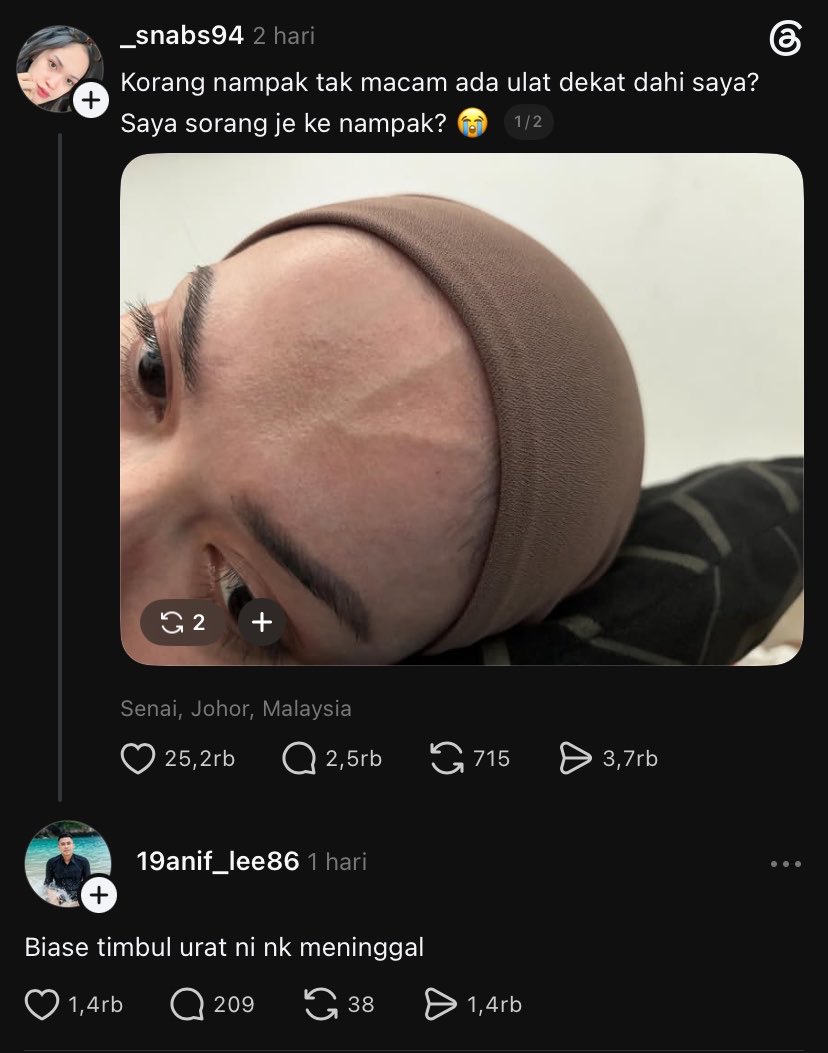 xyshulu's tweet photo. Dua hari yang lalu lewat postingan kaka ini nanyain kenapa ada urat di dahinya, trs ada yang reply kalau itu pertanda mau meninggal. Lalu datang kabar duka pagi ini, kalau kaka yg bertanya itu sudah berpulang. Rill umur ga ada yang tau, Alfatihah buat kakanya🙏🏻🥀 https://t.co/AU0crsobux