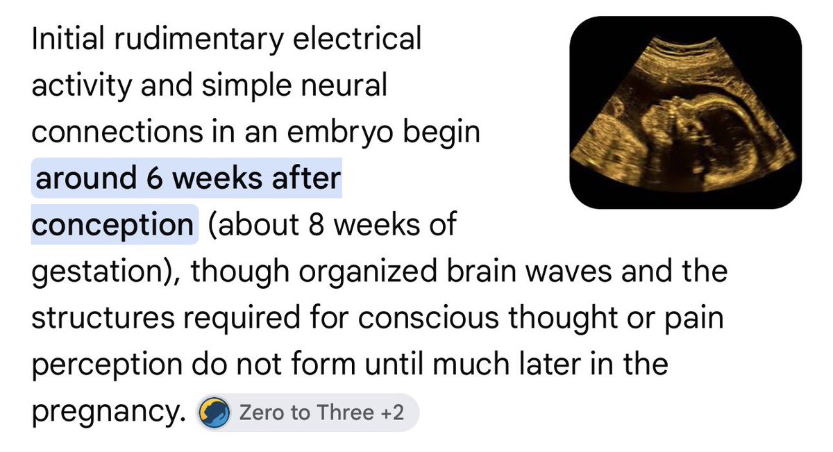 FormlessEntity's tweet photo. @QuentinWKramer @hypergameme Your definition of consciousness is closer to simply being human.

If there were any profit in it perhaps someone could configure a neural net with a few million nerve endings and train it to smile like a baby.

Kinda still sounds like “soul” talk to me. https://t.co/5xl9HdU7Qi