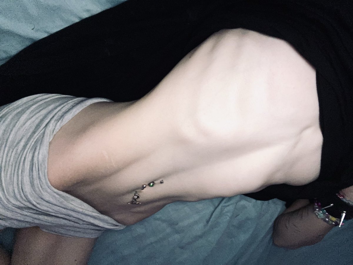 0livee_woof's tweet photo. Am I thinspo yet? ୭⋆˚⊹𐂯 https://t.co/ZrT8EBTM36