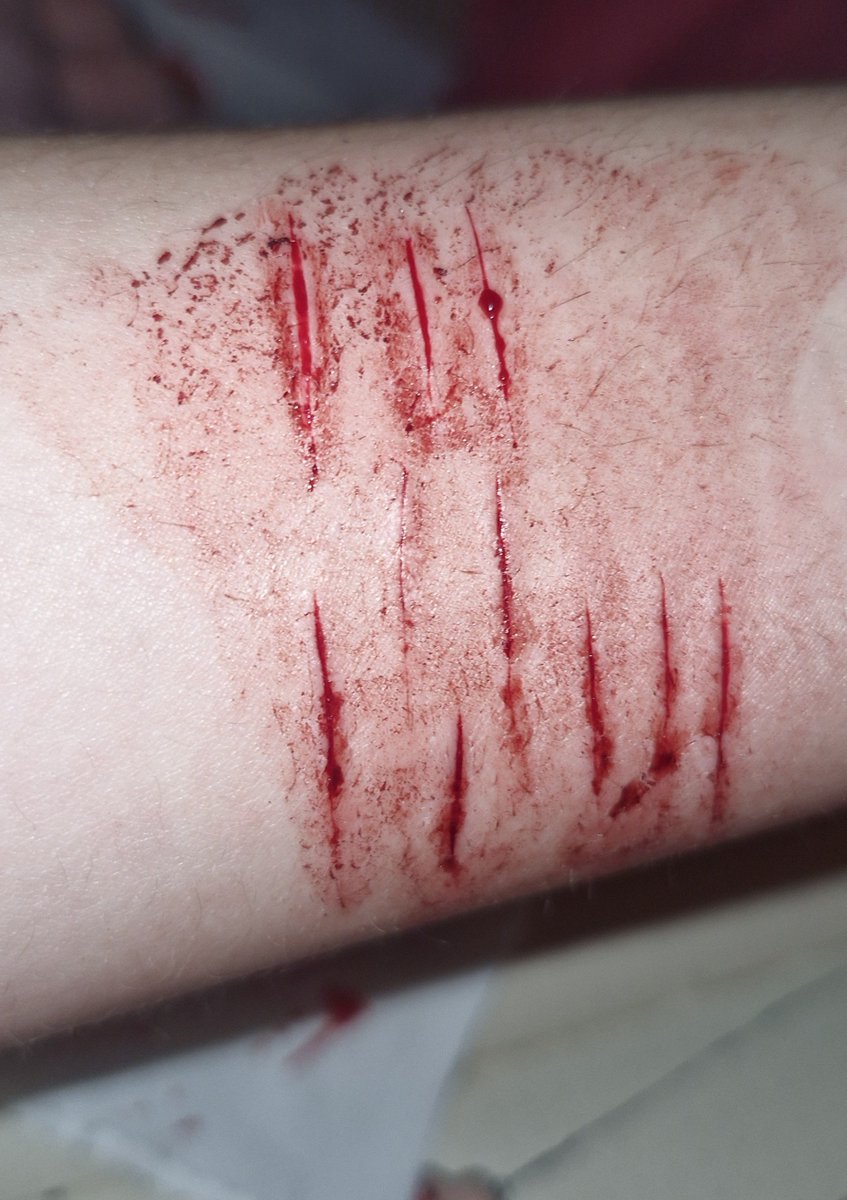 m4h001's tweet photo. perdi 17 dias limpa mas to feliz msm assim. fiz esses pra pintar pq fiquei com mtt vontade, dps posto o desenho (ignorem o braço peludo)
all fake, fake body, made with IA, sfx makeup
#shtwt #slittwt #sharm #988twt #sfxmakeup #ai https://t.co/do0U8xb6X8